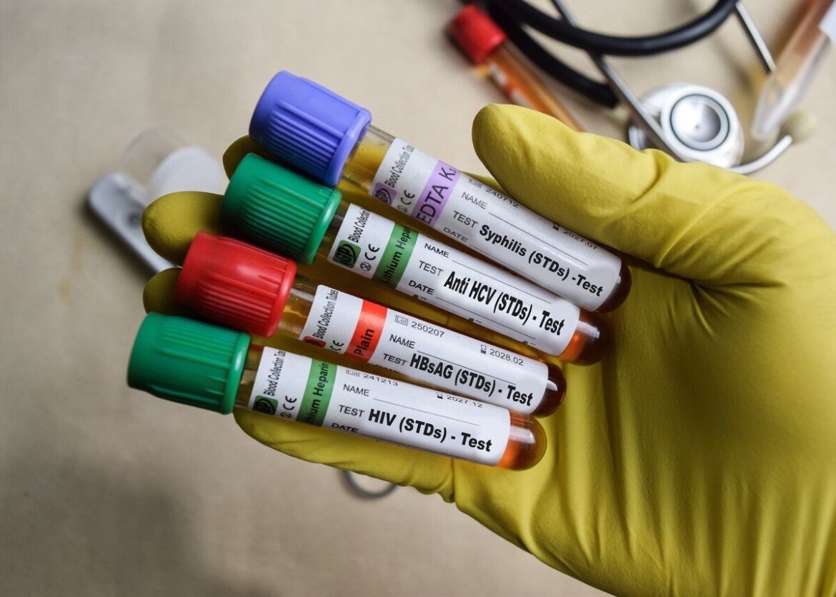 Zorgelijke toename aantal soa's in Spanje